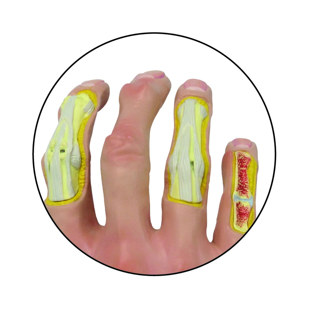 Modelo de mano con osteoartritis Código: TB1019520 - Imagen 2